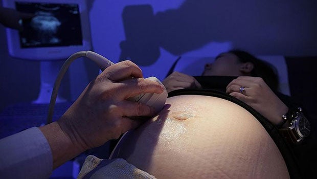 More mums-to-be diagnosed with gestational diabetes