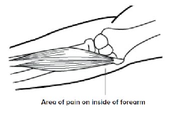 Golfer's Elbow  - SingHealth Duke-NUS Sport & Exercise Medicine