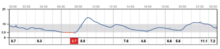 daily glucose curve - SingHealth Duke-NUS Diabetes Centre