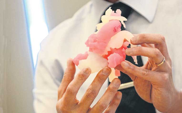  is more challenging when it involves children as they are smaller in size. This is where having a heart printed in 3D form can be very useful.