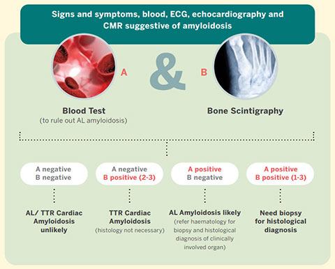 TTR signs and symptoms