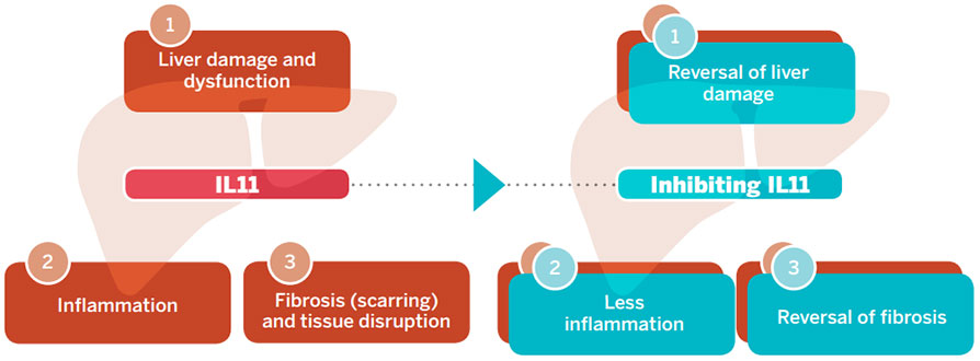 IL11 effect on liver