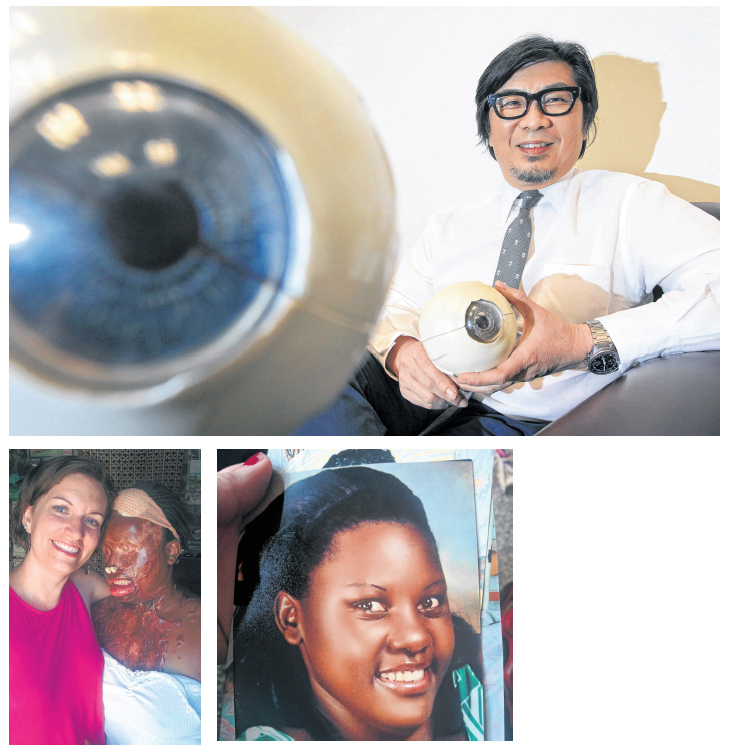  if need be, operate on her, pro bono. (Left) Ms Allen before the attack and (far left) now, standing next to social activist Lynsay Lewis. PHOTOS NEO XIAOBIN, UPASUAJI AFRICA.