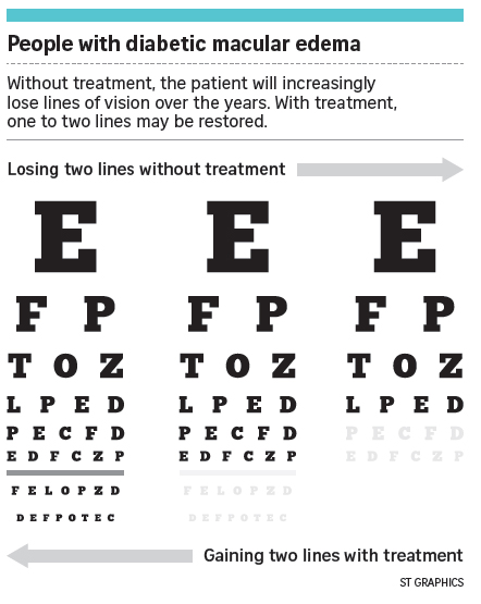  ​Without treatment, the patient will increasingly lose lines of vision over the years. With treatment, one to two lines may be restored.