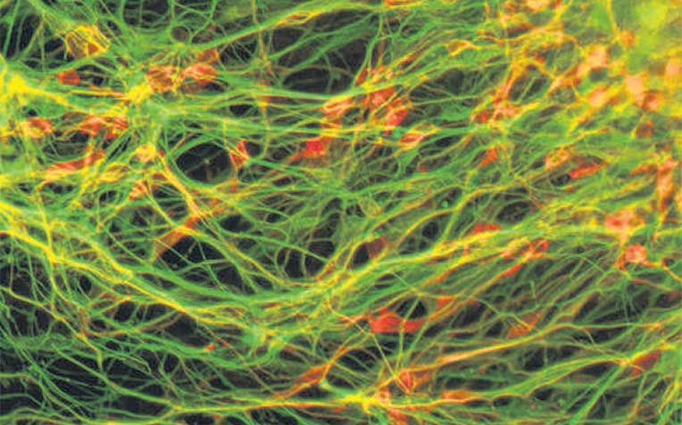 grown from “induced pluripotent stem cells” derived from the lining of a human umbilical cord, by a team of local scientists who think that such regeneration of neurons could be used to reverse the
effects of Parkinson’s.
