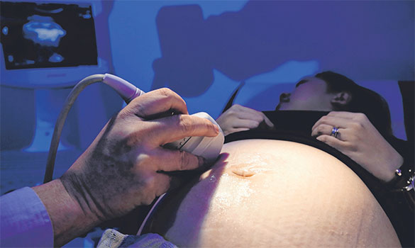  ​has one of the highest gestational diabetes rates in the world, with one in five births affected by it. 