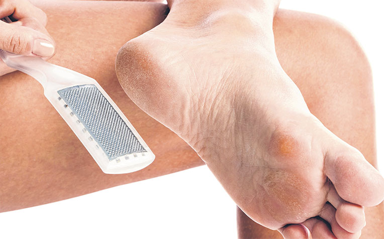 is the safer way to remove thickened skin. But do not file too aggressively and, if unsure, seek help from a podiatrist.