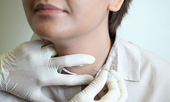 ​is a gland at the base of the neck, and the thyroid hormone regulates our body's metabolism. PHOTO ST FILE