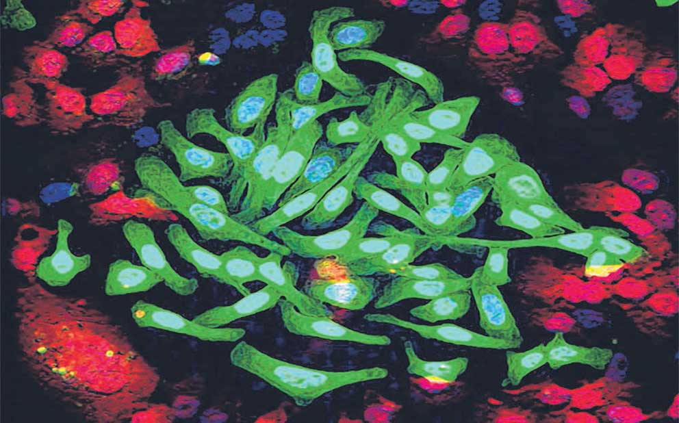  ​Research on lung cancer should no longer just be about finding specific gene mutations, or drugs that can block them, says Associate Professor Tan Eng Huat from NCCS.