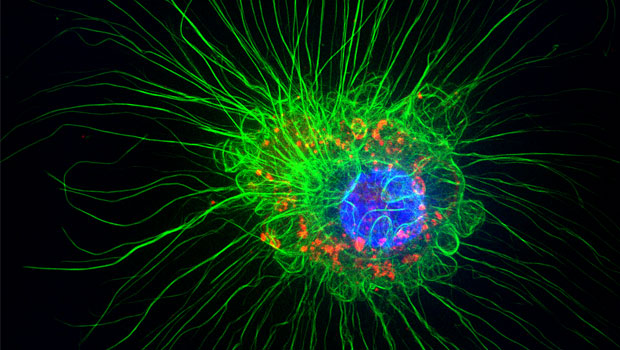  ​Human umbilical vein endothelial cells