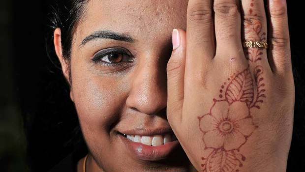  ​Ms Simren's eyeballs had begun to take on a cone-shaped appearance, due to a disorder called keratoconus. She underwent a cornea transplant for her right eye using a method called Dalk last year and is happy with the result.  PHOTO LIM YAOHUI FOR THE STRAITS TIMES