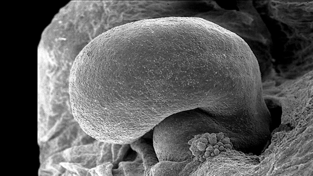  ​Above The proepicardium is a layer of cells that form the epicardium that surrounds the heart. 