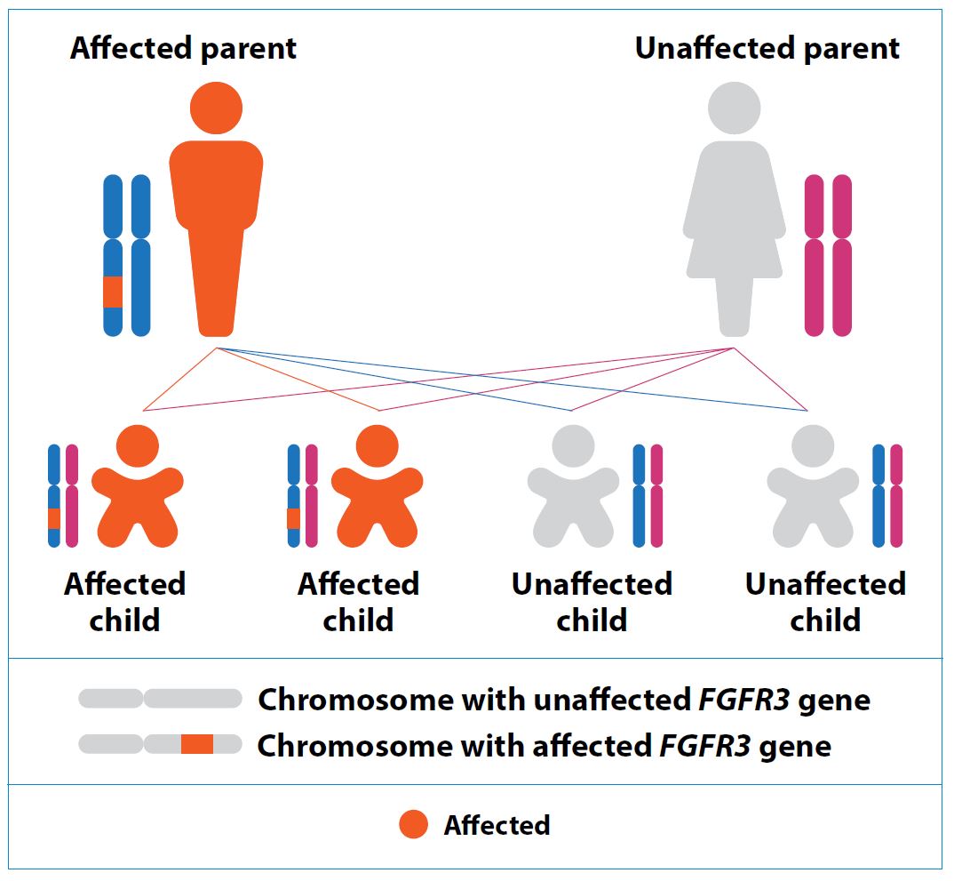 Achondroplasia is passed down in a dominant inheritance pattern | SingHealth