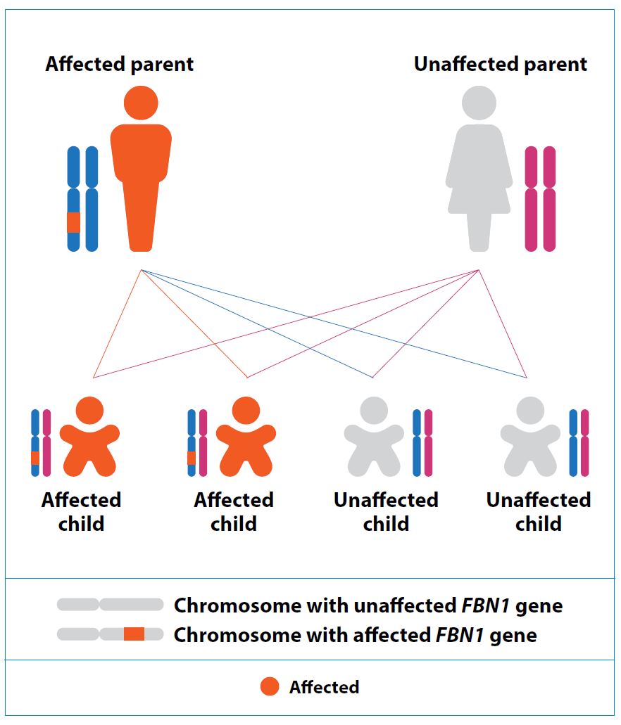 Marfan syndrome inheritance pattern | SingHealth