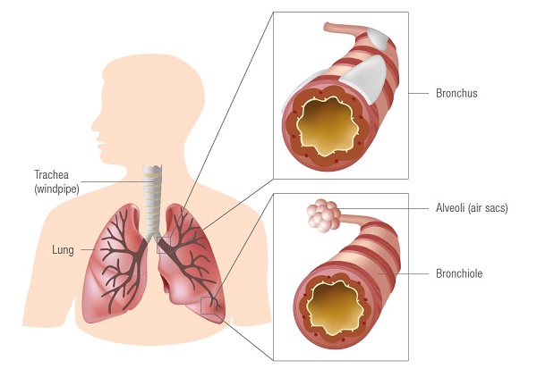 Lung Cancer - Diagram of Lungs | SingHealth