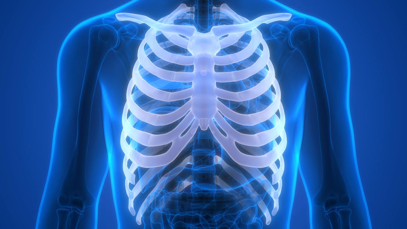 Costochondritis is a chest wall condition | SingHealth