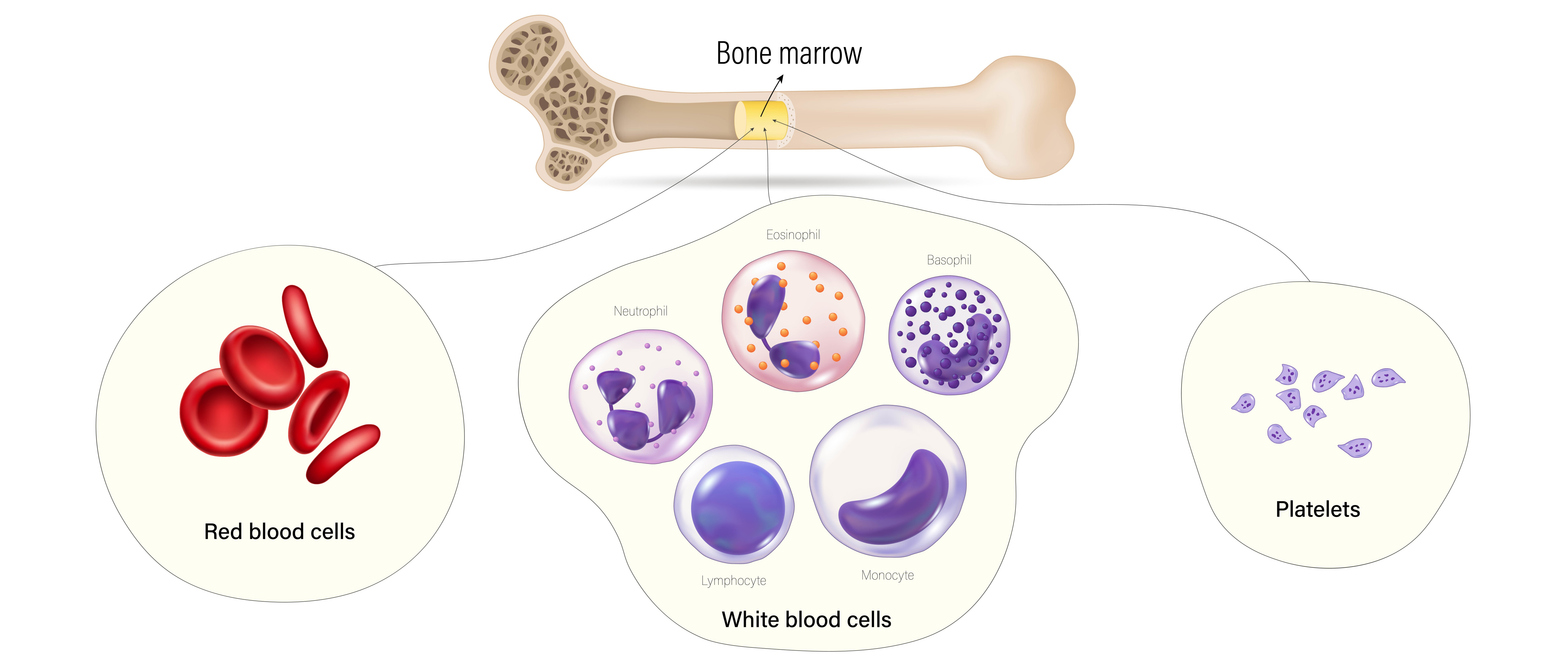 bone marrow of someone with aplastic anaemia