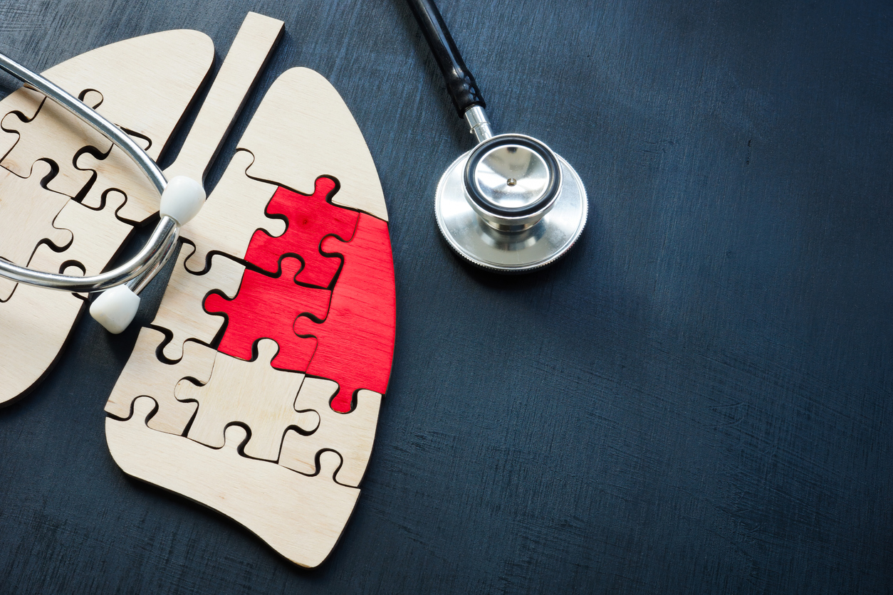 Diagnosing lung cancer | SingHealth