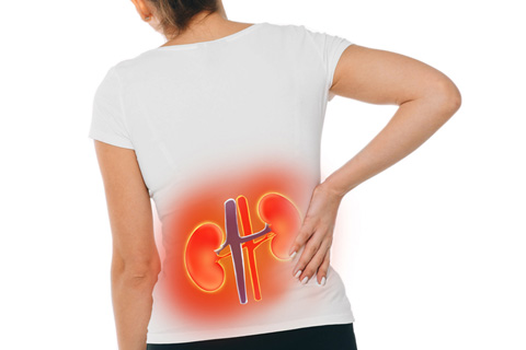hydronephrosis experienced by a woman