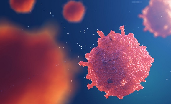 Sarcomas are rare and aggressive cancers in the bones and tissues | SingHealth