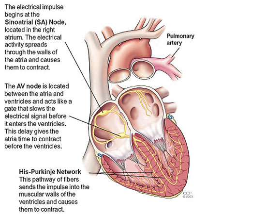 catheter ablation conditions & treatments