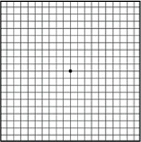 Normal Vision Amsler Grid - Age-related Macular Degeneration