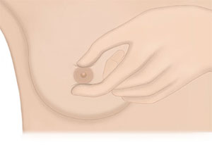 Breast Self-examination