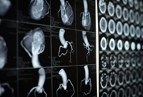 Cardiac Computed Tomography (CT) scan Singapore SingHealth