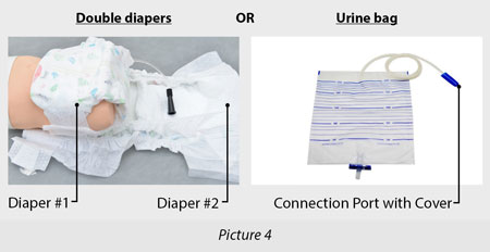 urine bag for catheterisation