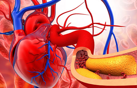 Cholesterol Management - SingHealth