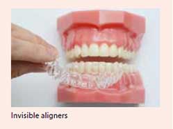 Invisible braces treatment for malocclusion available at National Dental Centre Singapore.