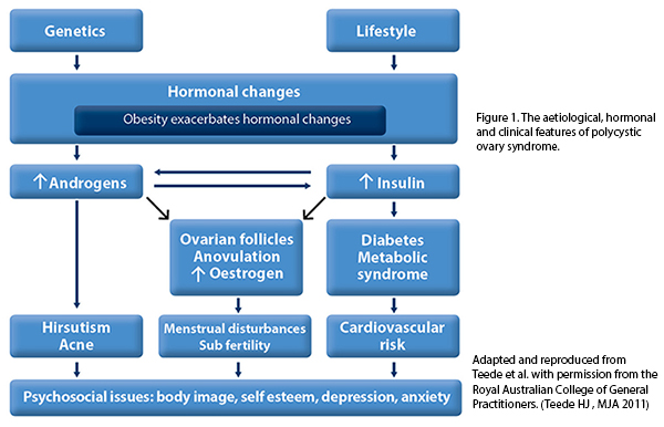 Polycystic Ovary Syndrome (PCOS) Conditions & Treatments