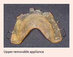 jaw malalignment conditions & treatments