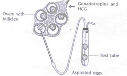 hormonal stimulation induces superovulation