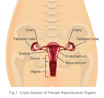 Ovarian cancer cross section of female reproductive organs KKH