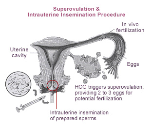 Insemination Pregnant Before After