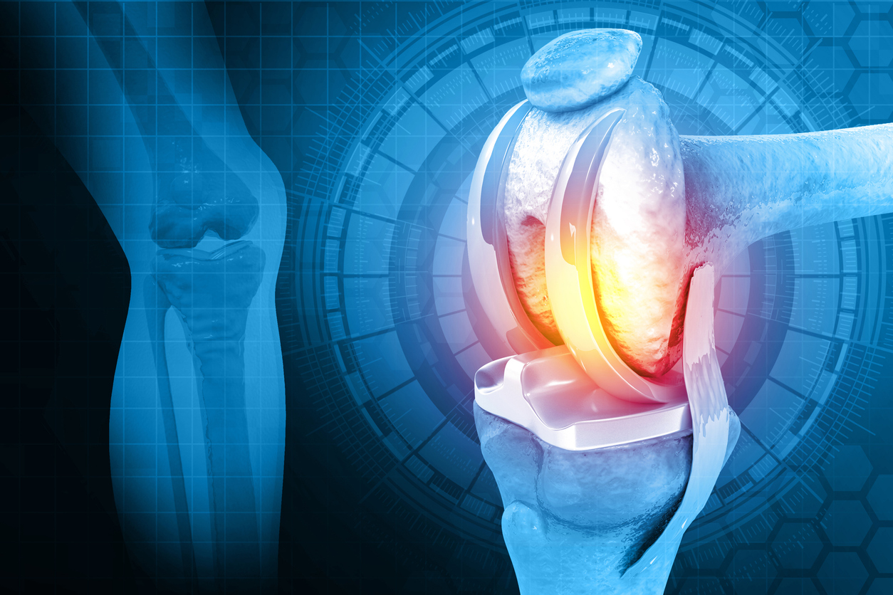 Total knee replacement surgery - SingHealth
