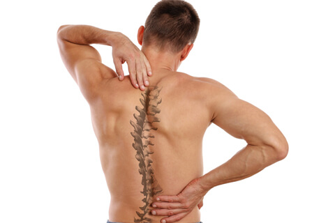 scoliosis anatomy - conditions and treatments