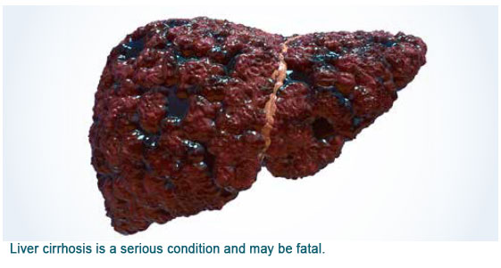 liver cirrhosis conditions and treatments