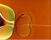 Intracytoplasmic sperm injection