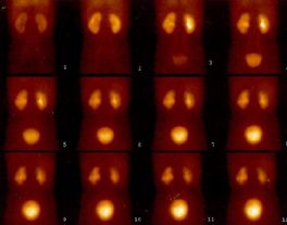 kidney scan conditions & treatments