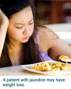 obstructive jaundice conditions & treatments