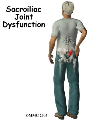 Sacroiliac Joint Dysfunction Singapore General Hospital