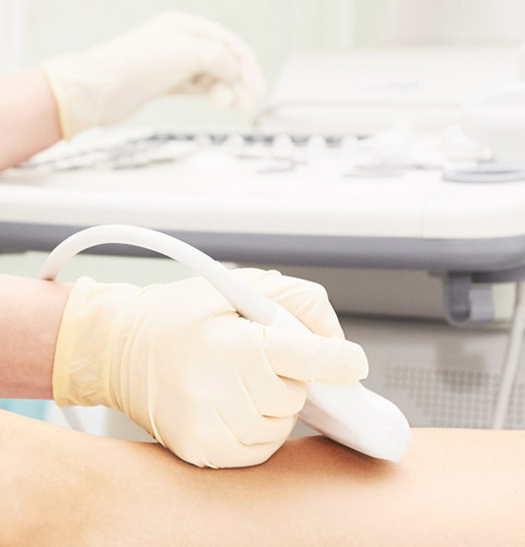 Vascular Investigation Condition and Treatment